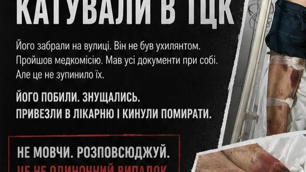 «Набряк мозку та гематоми»: у Білій Церкві чоловік опинився в реанімації після перебування в ТЦК