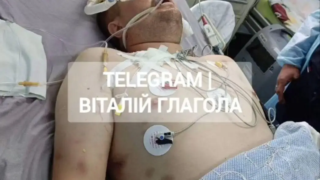 Смерть після ТЦК на Закарпатті: центр заперечує побиття мобілізованого