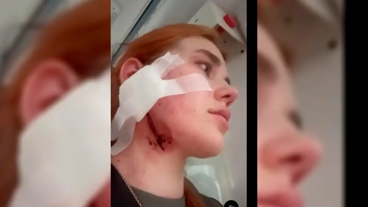 Жах у Вроцлаві! Троє поляків жорстоко побили українця та його дівчину через акцент: напад потрапив на відео