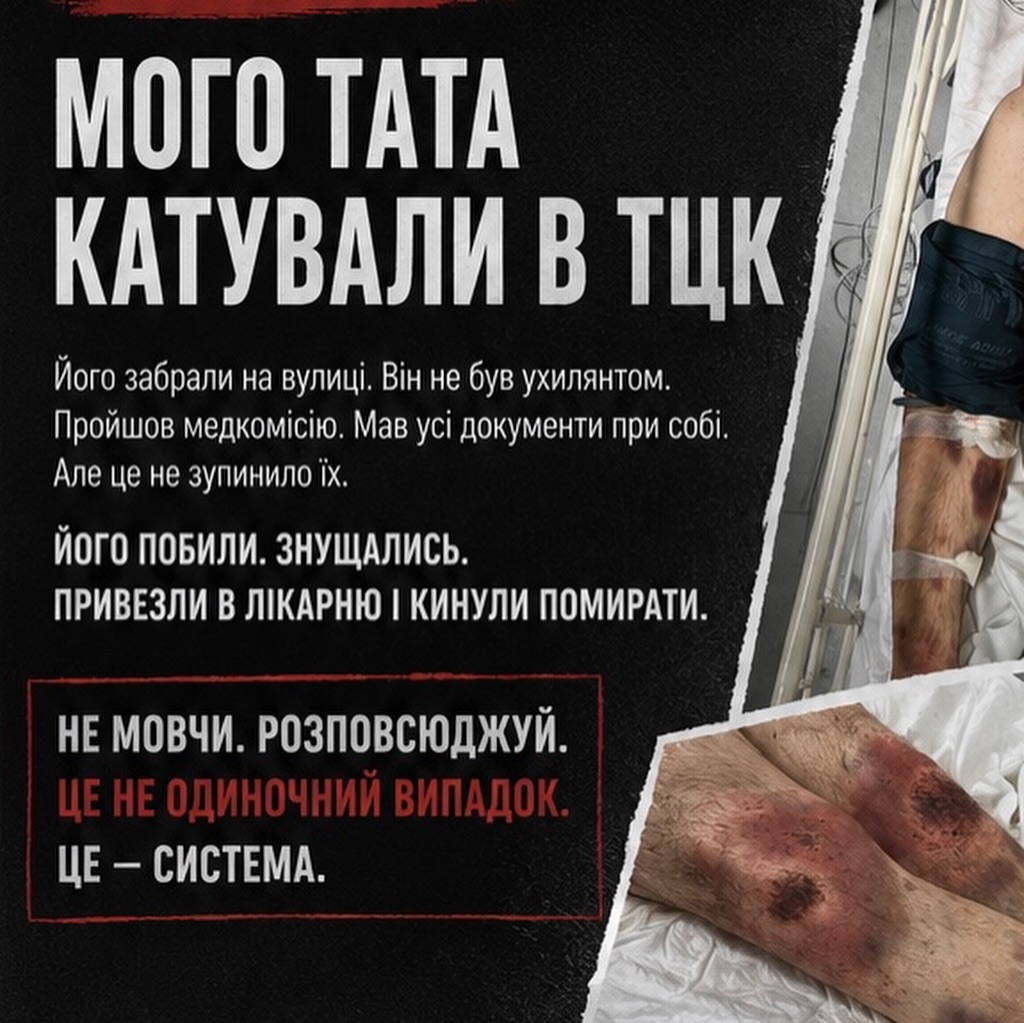 «Набряк мозку та гематоми»: у Білій Церкві чоловік опинився в реанімації після перебування в ТЦК