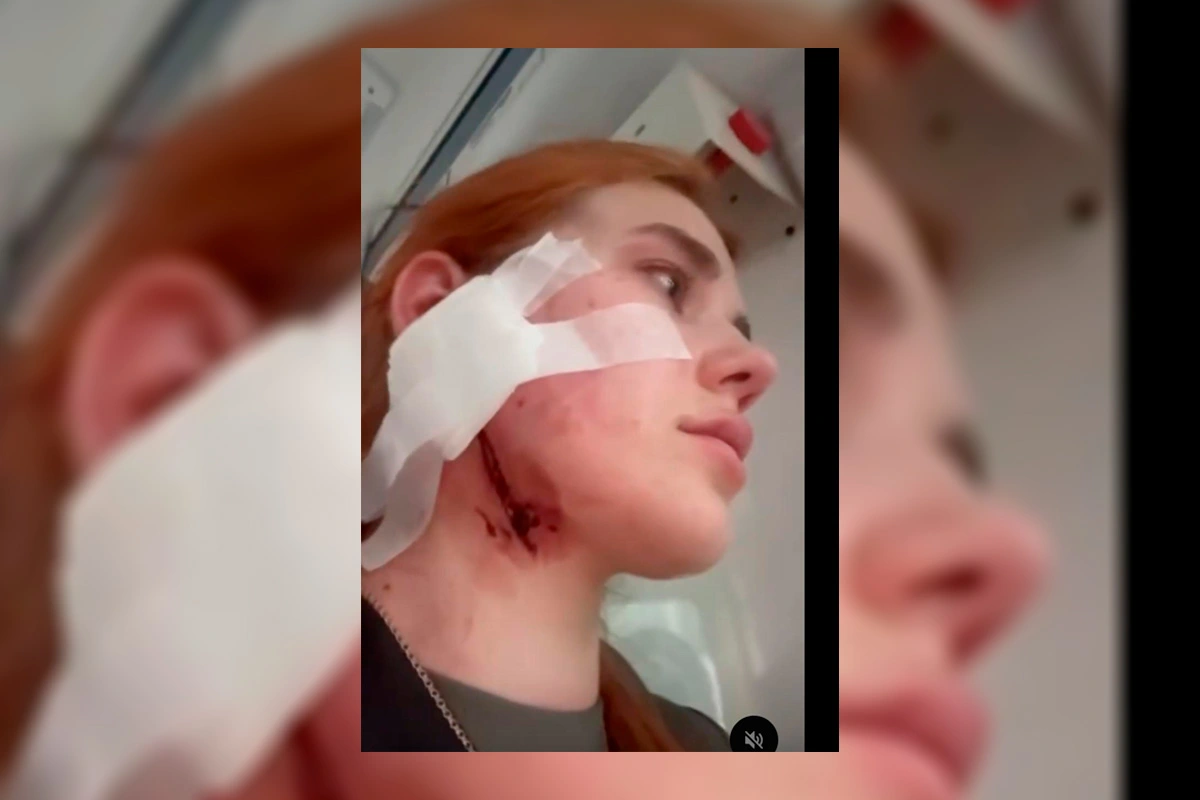 Жах у Вроцлаві! Троє поляків жорстоко побили українця та його дівчину через акцент: напад потрапив на відео